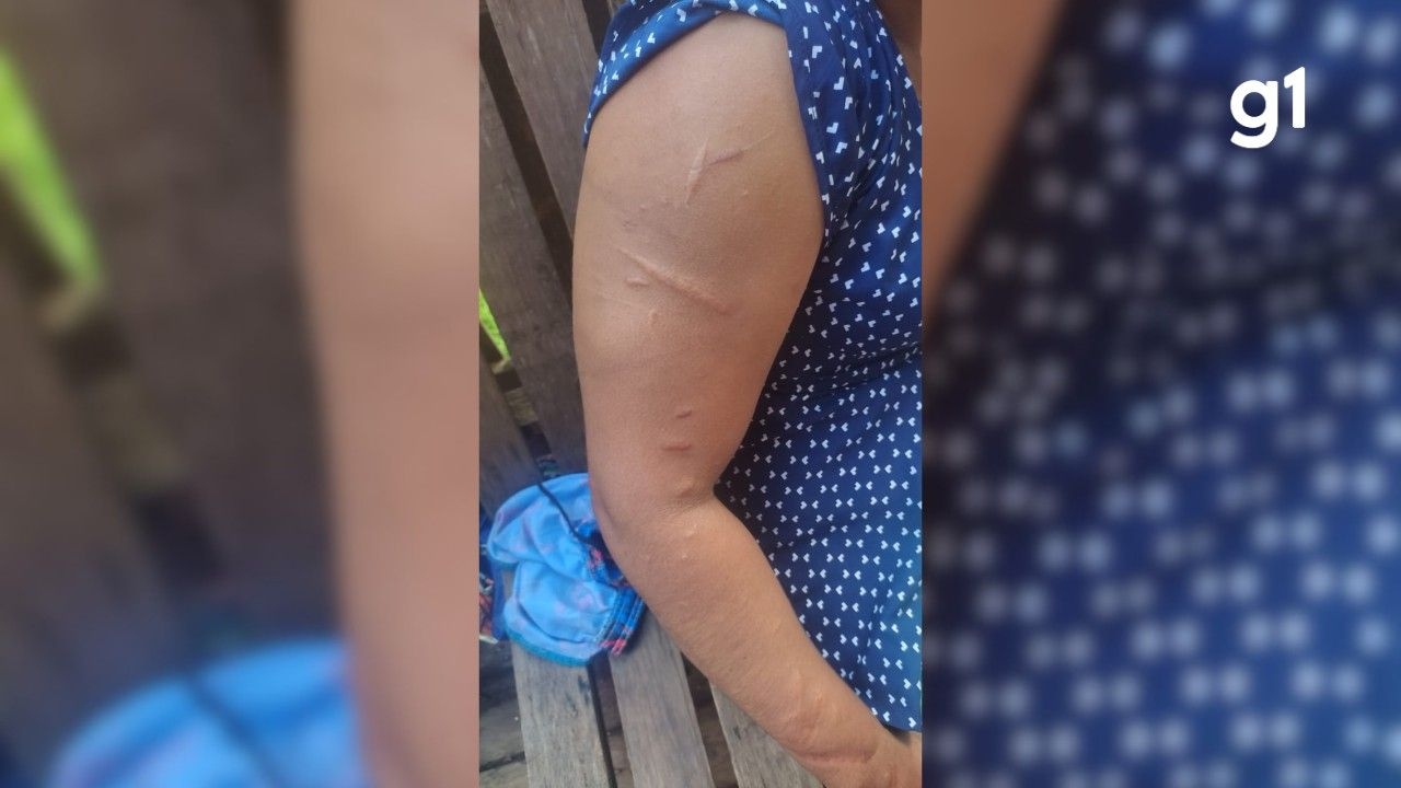Mulher resgatada após viver 15 anos em cárcere no AP