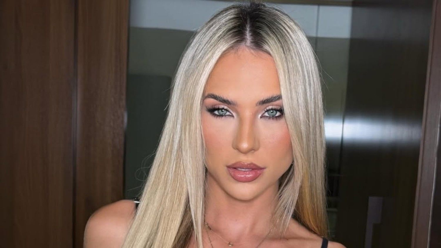 Naturalidade no preenchimento labial ganha destaque entre famosas