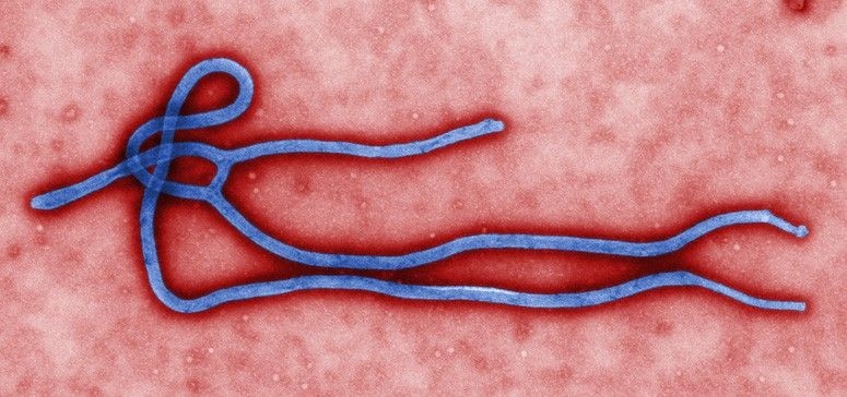 Ebola descartado em caso suspeito no Brasil