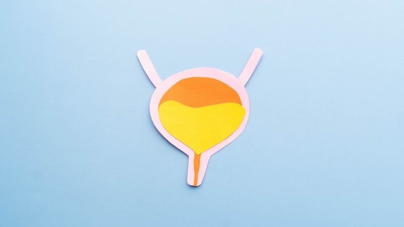 Identifique e previna-se contra o câncer de bexiga